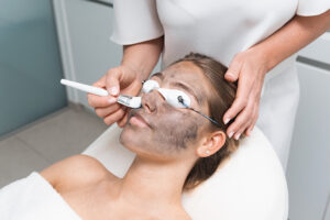 Carbon laser peeling in Maldegem en Lievegem